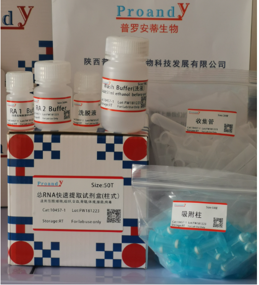 總RNA提取試劑盒（柱式）-1.png